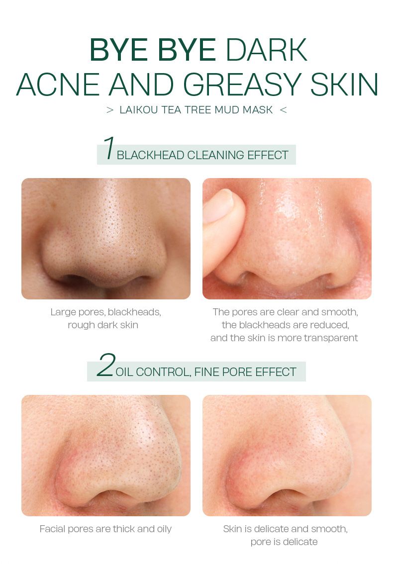 Makeup Tool Kits LAIKOU Tea Tree Mud Mask 1 Piece 5g Moisturizing Refreshing Mud Mask_voghion.com