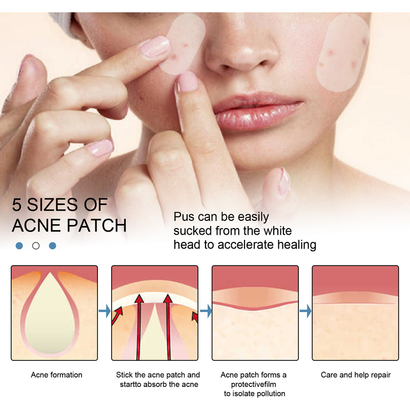 EELHOE Invisible Cleaning Patch Anti acne Closed mouth Acne Waterproof Topping concealer Hydrocolloid_voghion.com