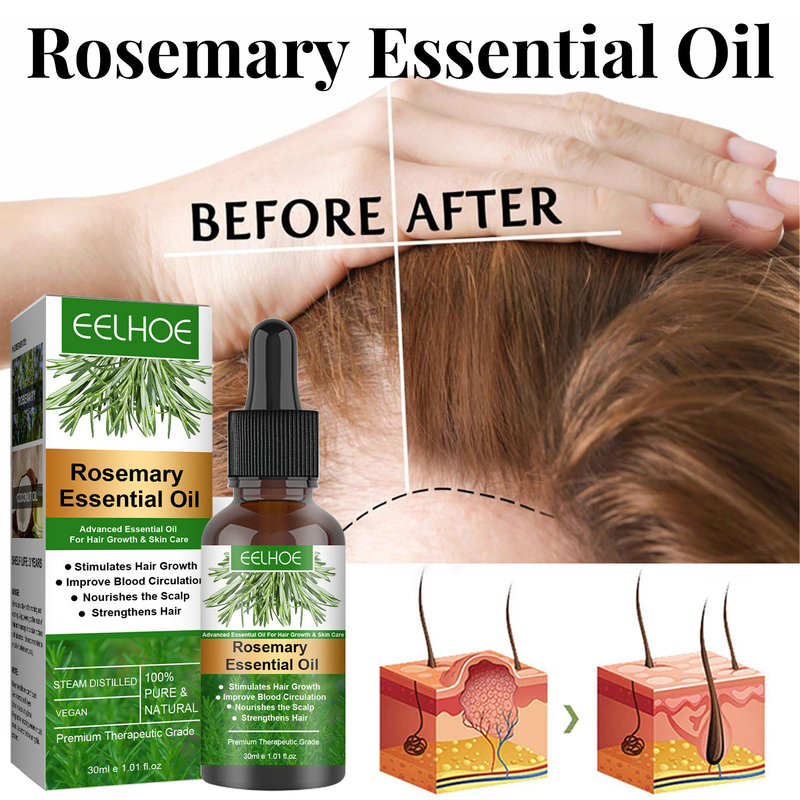 EELHOE Rosemary Breaking Care Growth and Anti Loss eterisk olja för närande hår_voghion.com