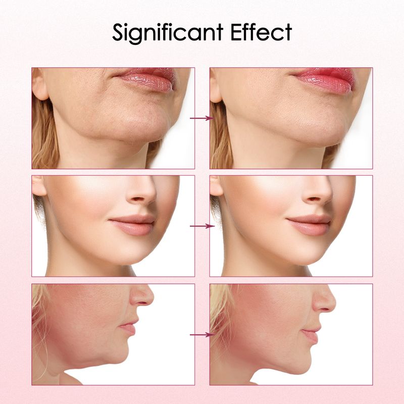 V Dispositivo de levantamento facial Remoção de queixo duplo Instrumento de beleza Multifuncional Micro-corrente Facial Pele Emagrecimento Massagem Firmeza_voghion.com
