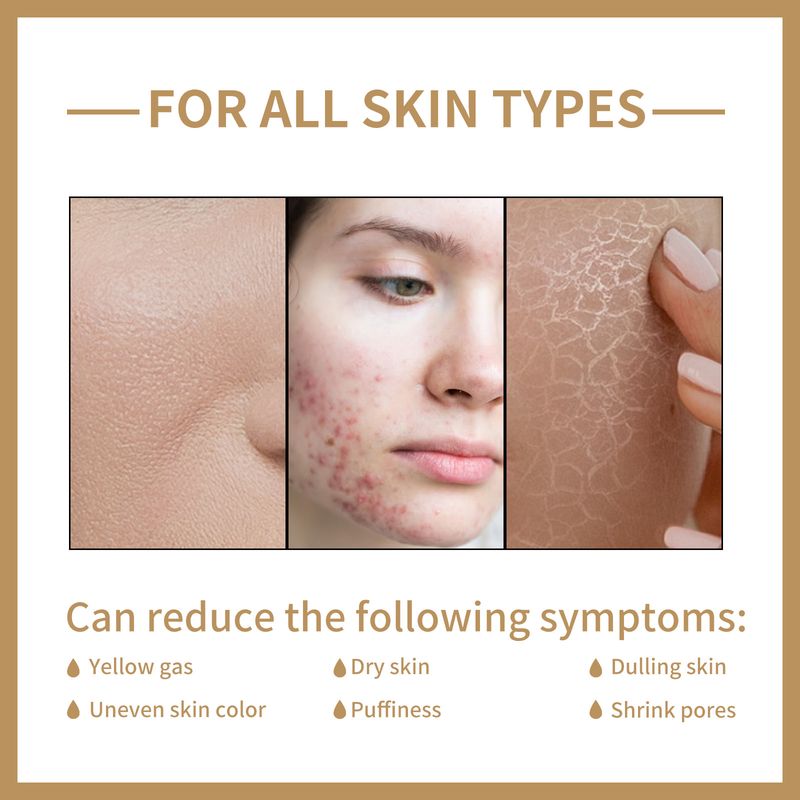 Gözenek Küçültücü Serum Nemlendirici Tonik Sivilce Lekelerini Giderir Gözenekleri Pürüzsüzleştirir Kuru Yağ Kontrolü Aydınlatır Akne Tedavisi Esans_voghion.com