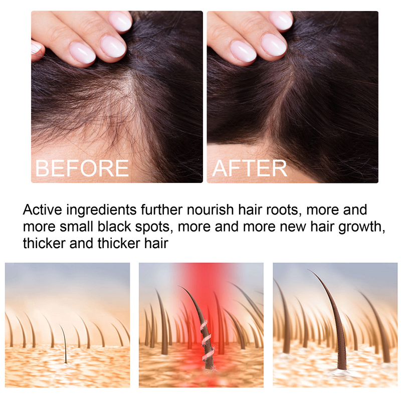 EELHOE Massaggio del cuoio capelluto per la crescita dello zenzero Idratante Spray nutrizionale per la cura dei capelli spessi e resistenti_voghion.com