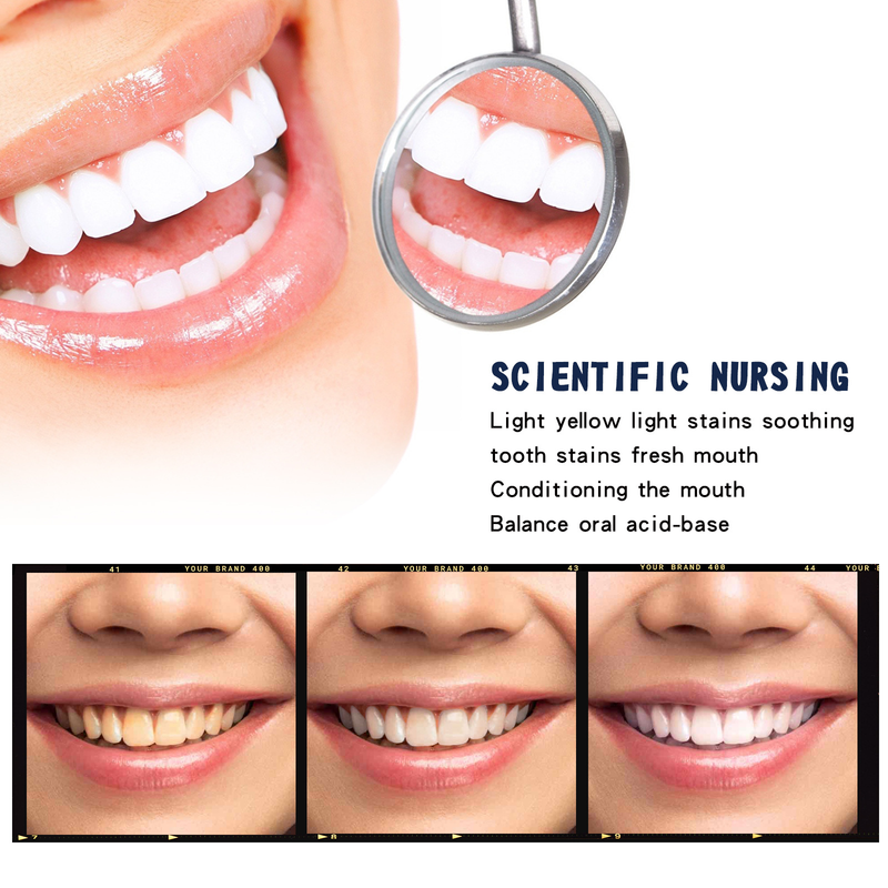Tooth Whitening OUHOE essence Tooth Stain Removing Yellow Tooth Stain Refreshing Breath Cleaning Tooth Care essence_voghion.com