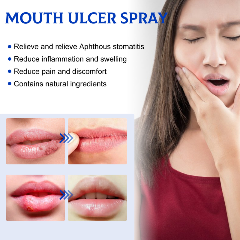 Oral South Moon Repair szájspray a gingivális tűz, duzzanat, fájdalom és fogágybetegség okozta hólyagosodás enyhítésére_voghion.com
