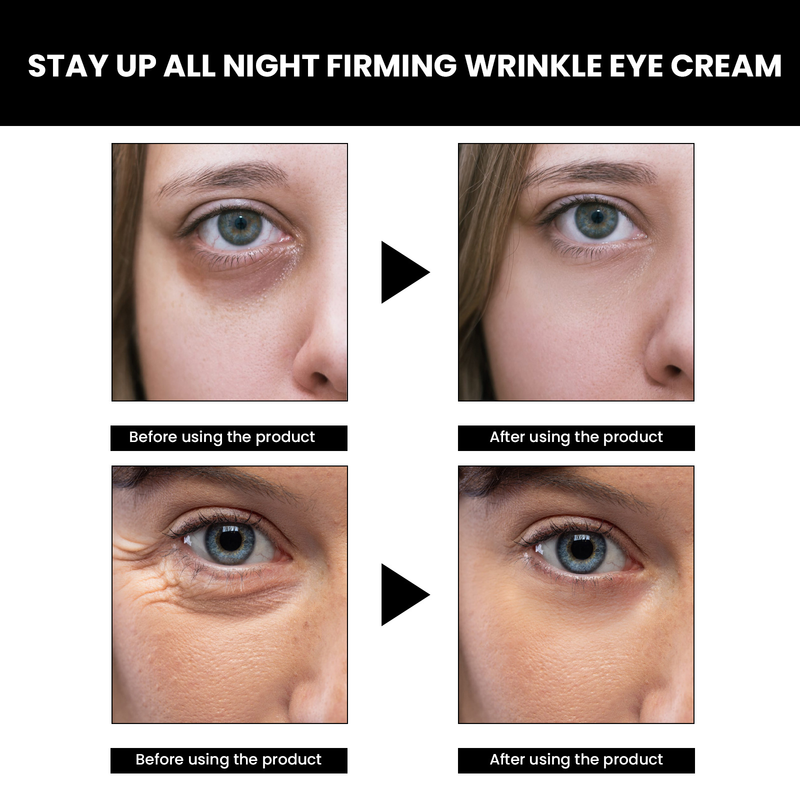 Eye Firming Beautiful Cream Relieves Wrinkles, Bags, Black Eyes, Firms, Moisturizes, and Repairs Skin Around the Eyes _voghion.com