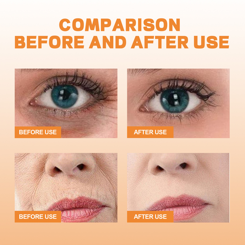 EELHOE Augenmasken-Spray-Set, Rekombinationsfalten, Anti-Aging, Kollagen, feuchtigkeitsspendend_voghion.com