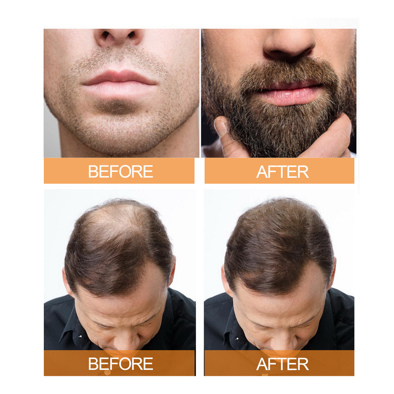 Jayswing Growth spray Men's Beard Dense Care Fluid Toughening Hair Quality Prevention_voghion.com