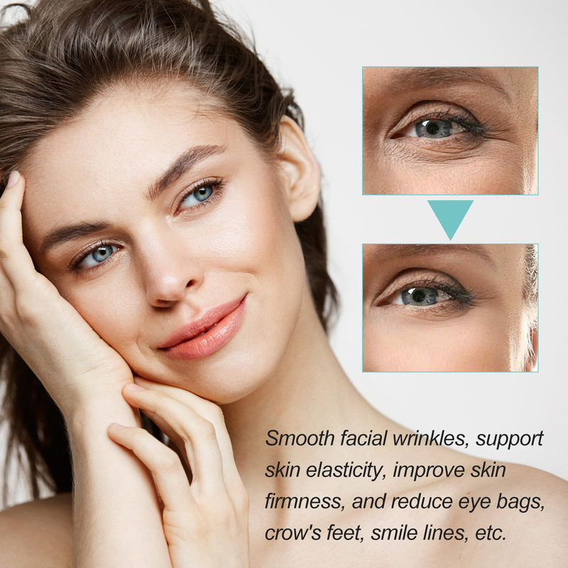 Black Spot Correction Cream Moisturizing, Moisturizing Lightening Skin Spots Melanin Rejuvenating, Brightening_voghion.com