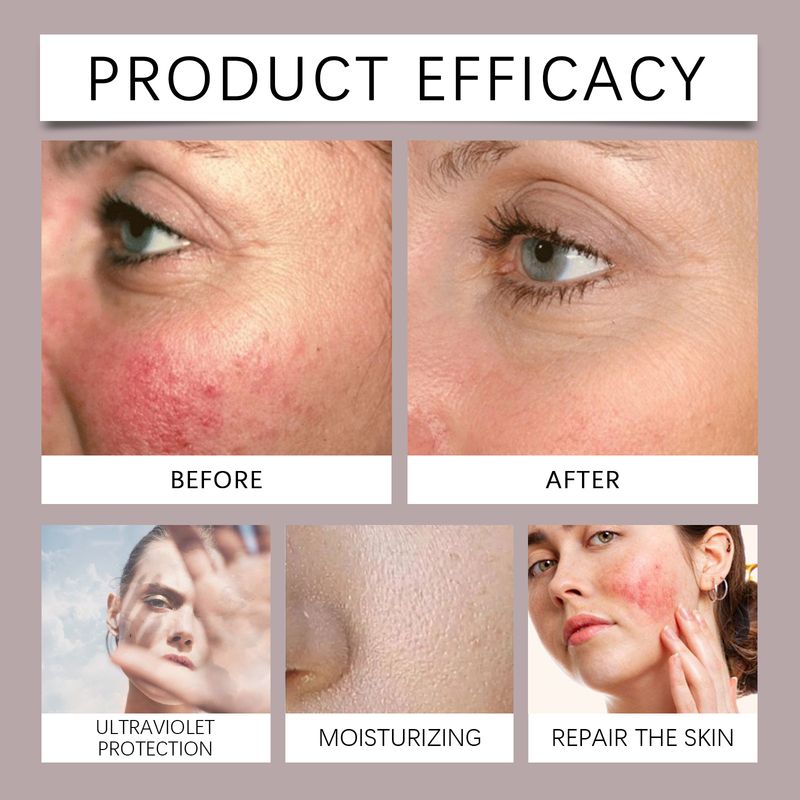 Hoygi Tallow Moisturizing Protective Cream, Outdoor Protection, Moisturizing, Nourishing, Hydrating, Soft And Gentle Isolation_voghion.com