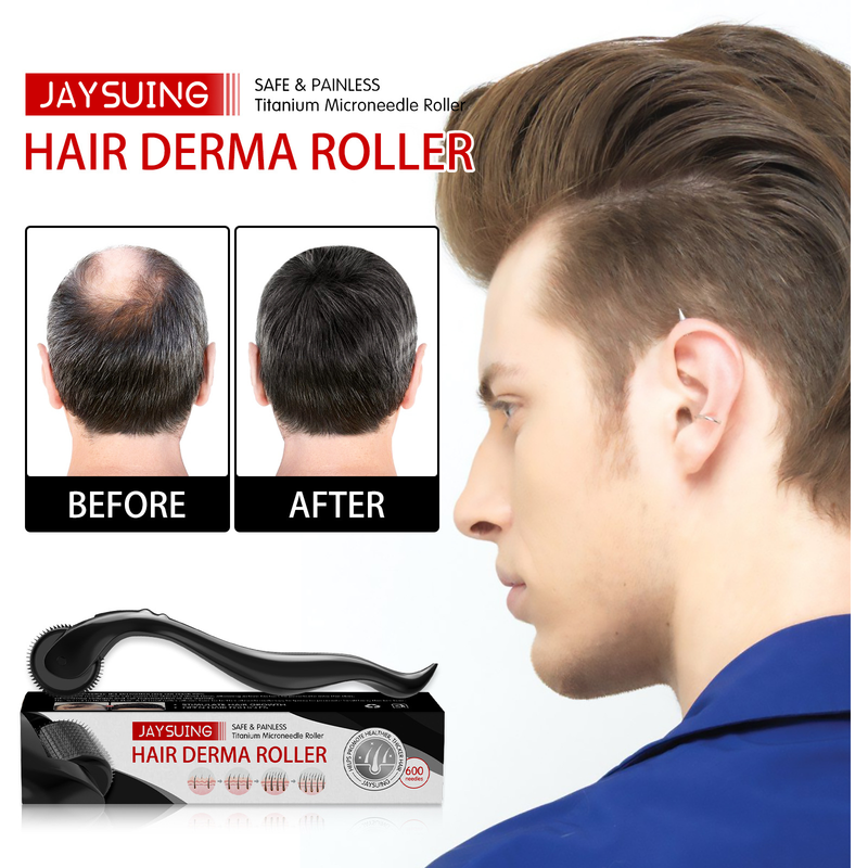 Jaysuing Scalp favorise l'épaississement du peigne à cheveux de massage à rouleaux_voghion.com