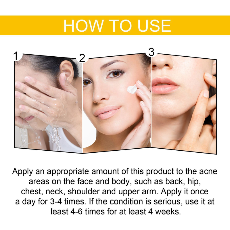 EELHOE Facial Skin Care Cleansing&Reducing Spots, Eliminating Acne and Shrinking Pore essence_voghion.com