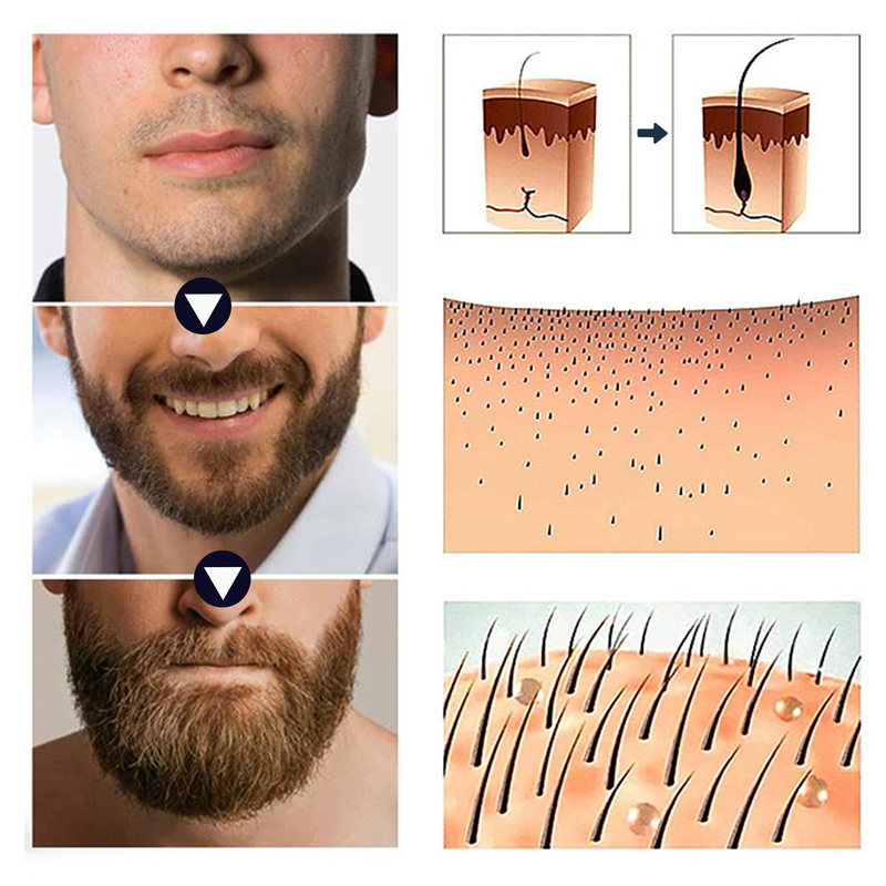 OUHOE Massaggio alle erbe Idratante Radice dei capelli del cuoio capelluto Resistente e morbida Essenza per la cura della barba densa_voghion.com