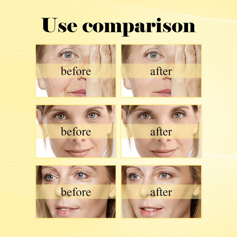 EELHOE Deep Anti-Wrinkle Cream Anti-Aging, Lightening Spots And Fine Lines, Firming And Brightening Skin Moisturizing Cream_voghion.com