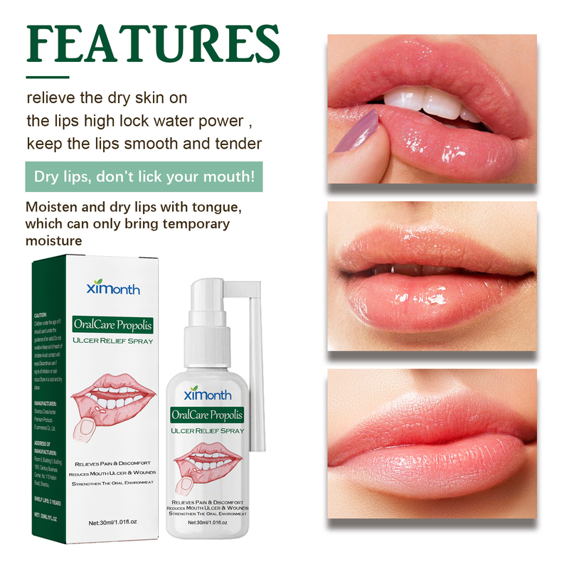 Oral ulcer XIMONTH relief spray_voghion.com
