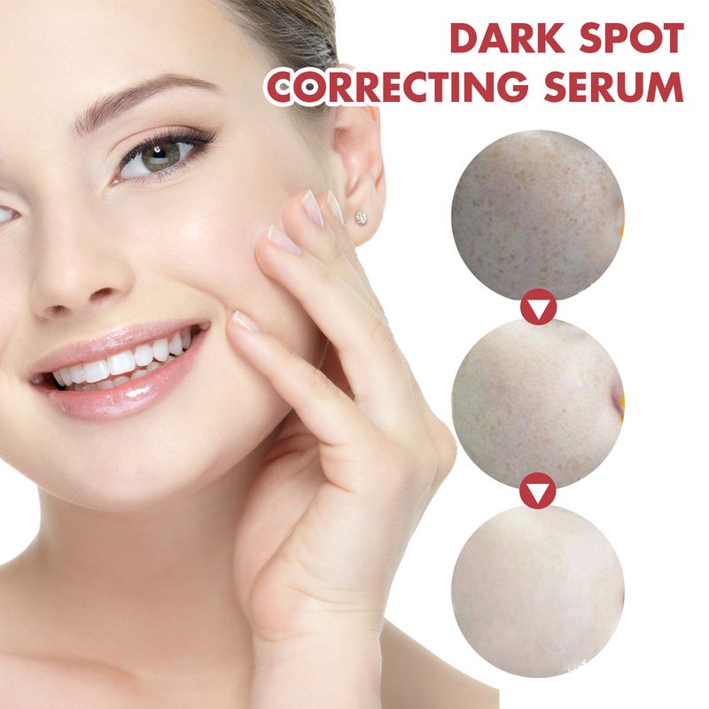 Hoygi Dark Spots Repair Essence, Feuchtigkeitsspendend an ophellend Reparaturessenz fir donkel Flecken an Altersflecken_voghion.com