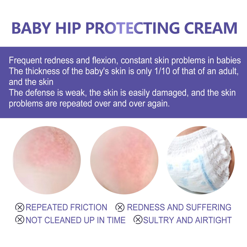 Hip Beautiful Baby Cream repariert Rötungen, Fieber und Juckreiz an der Babyhüfte und ist eine feuchtigkeitsspendende Hautpflegecreme_voghion.com