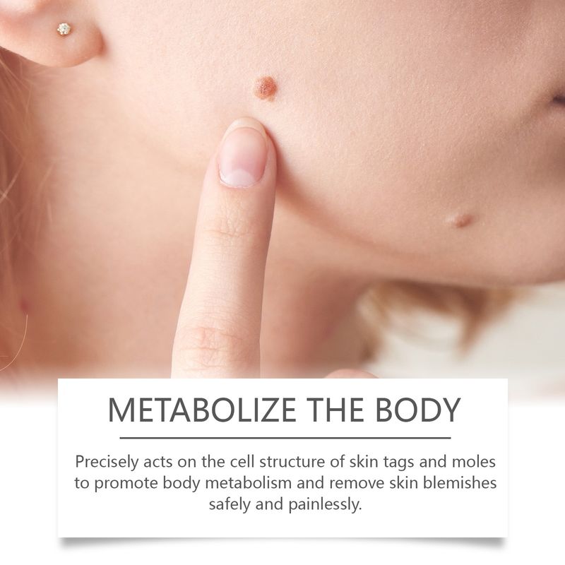 Patch XIMONTH pour verrues, réparation des acrochordons, peau lisse, nettoyage doux, soin des verrues et cors_voghion.com