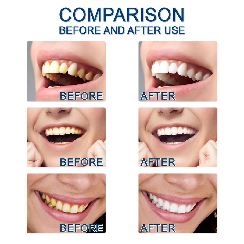 essence, tooth Tooth spot cleaning, tooth care, essence, tooth stain cleaning, yellow stain, tooth stain, fresh bre _voghion.com