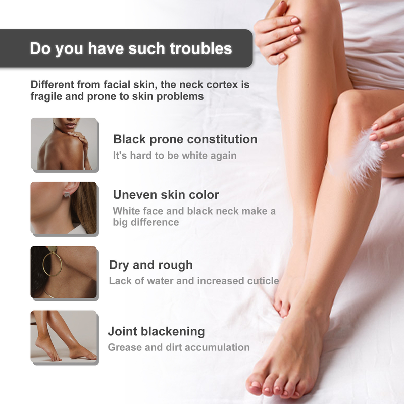 OUHOE Cream Repairs Underarm Elbow Joint Blackness, Brightens Skin Tone, Moisturizes Whitening and_voghion.com