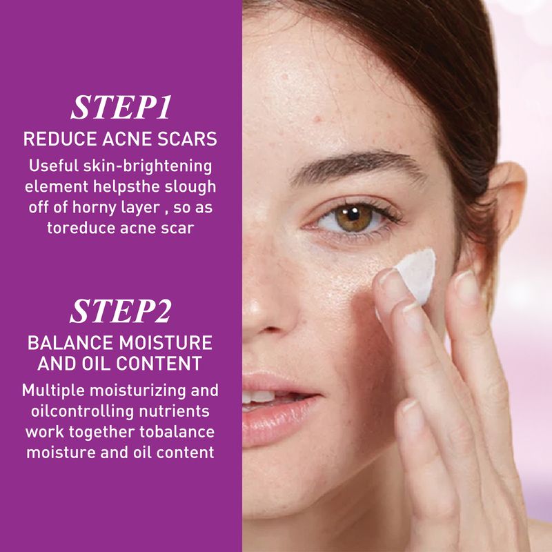 Crema per la rimozione dell'acne, riparazione, rossore, controllo dell'olio, restringimento dei pori, sbiancamento, idratazione, attenuazione delle macchie, crema anti-infiammatoria per il trattamento dei brufoli._voghion.com