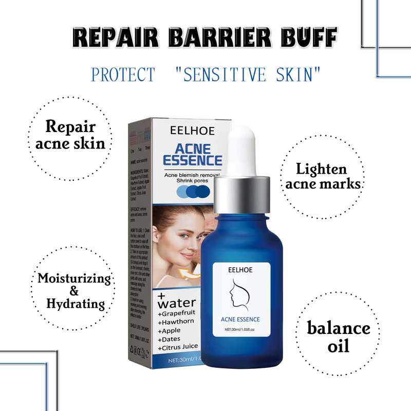 Kis kék üveges pattanásszérum, pattanások és pattanásfoltok tisztító pórusok, gyengéd helyreállító szérum_voghion.com