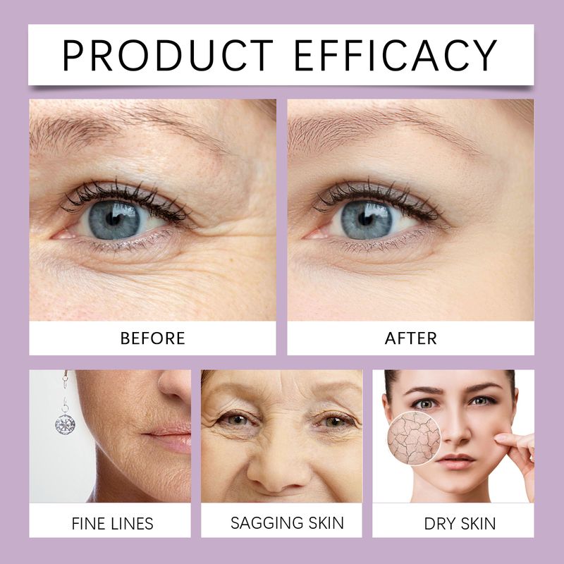 OUHOE Retinol Anti-Wrinkle Essence Hydrating, Lifting, Firming And Smoothing Fine Lines Moisturizing Skin Care Essence_voghion.com