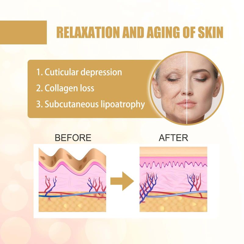 EELHOE Retinol Wrinkle Patch nutre la pelle, rendendola liscia e delicata, migliorando la riduzione delle linee sottili e delle rughe_voghion.com