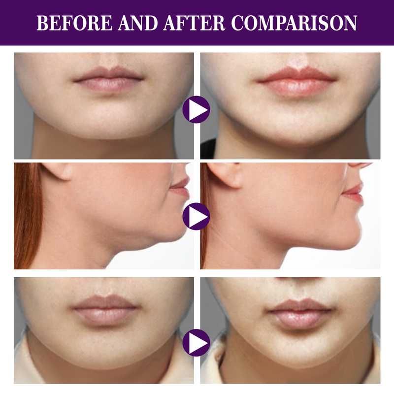 EELHOE Facial Tight Doppio Mento V-Face Guazi Cerotto Lifting Invisibile_voghion.com