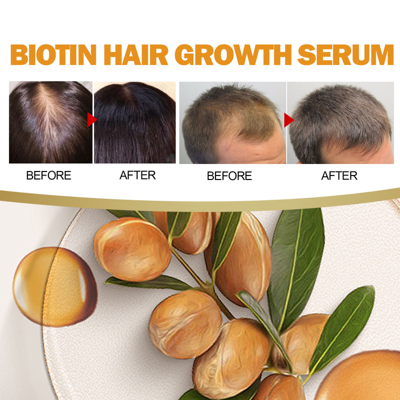OUHOE Biotină Anti-cădere, Reparare fixă, Hidratare rădăcină, Esență de balsam de păr dens_voghion.com