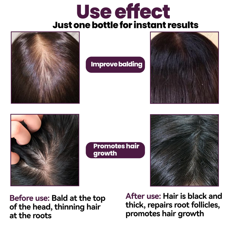 EELHOE foam growth care, strong anti dropping, stimulating follicle, long hair, nutrition and hair fixation_voghion.com