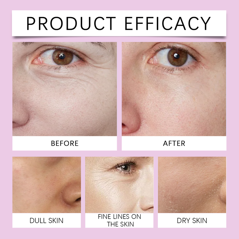Jaysuing Face Moisturizing Patch, Gentle Moisturizing Care Face Gentle Moisturizing Skin Care Patch_voghion.com