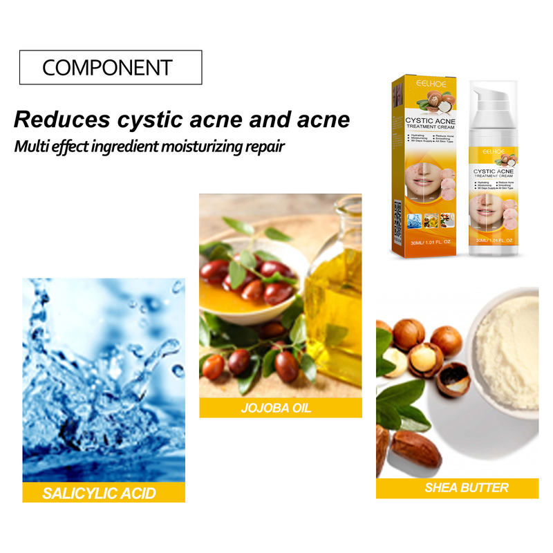 EELHOE Facial Skin Care Cleansing&Reducing Spots, Eliminating Acne and Shrinking Pore essence_voghion.com