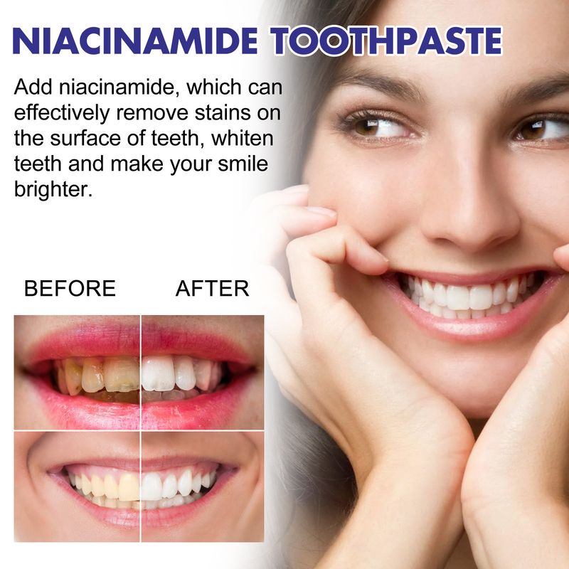 EELHOE Niacinamide Erfrischende Atemreinigung Oral Zahnfleischschutz und Zahnaufhellung Zahnpasta_voghion.com