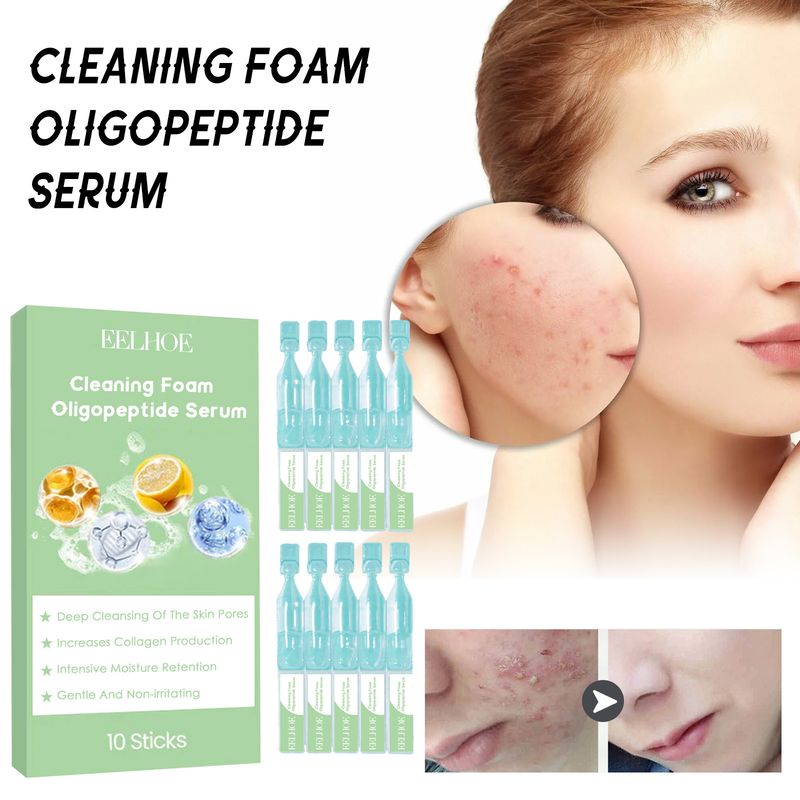 EELHOE oligopeptide cleanser foam essence softens cutin, brightens skin, cleanses pores eliminates blackheads and acne_voghion.com