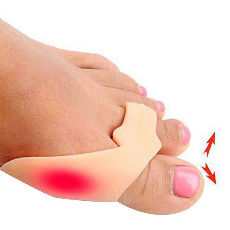 Correctores de Hallux Valgus del dedo gordo del pie de silicona, separadores, alisador de alivio de juanetes_voghion.com