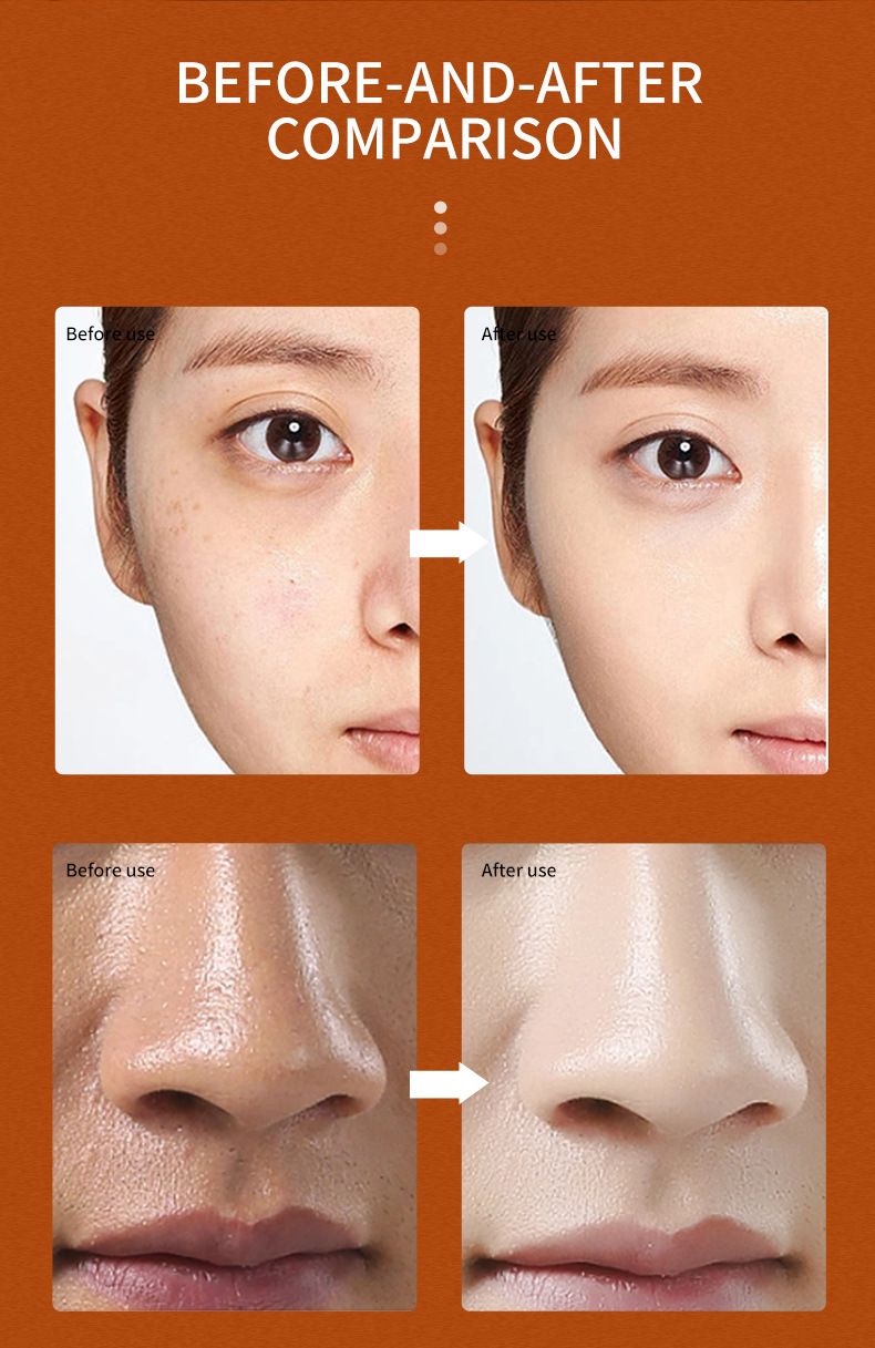 Bsncpley Blodappelsin Eksfolierende Gel Dybderensende Eksfolierende Creme til Døde Huder Rengørende Hud Fugtighedsgel_voghion.com