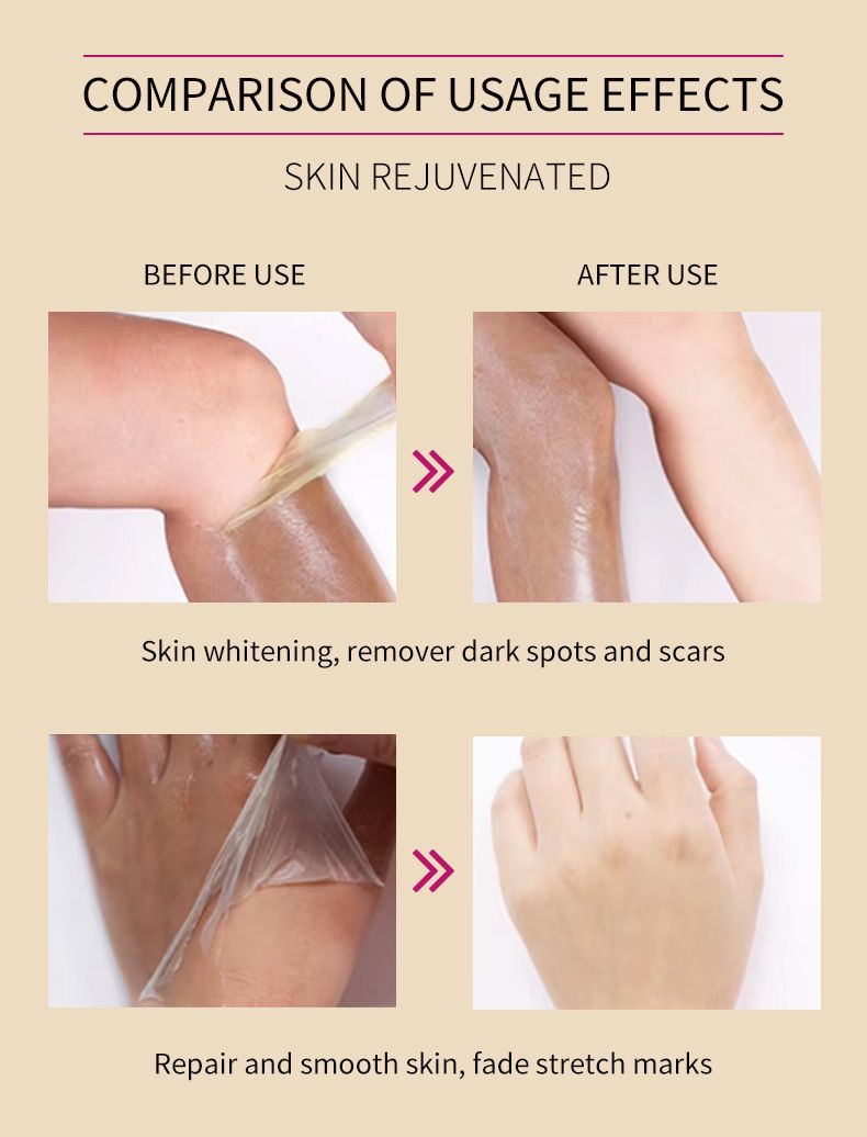 Voetverzorging Engelse Peeling Olie voor Handen en Voeten EXTRA STERKE PEELINGOLIE_voghion.com