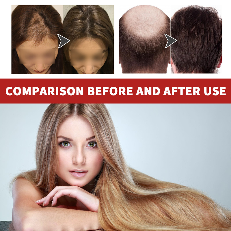 Ulei nutritiv pentru masaj reparator al scalpului Hoegoa essence, pentru păr dur și dens_voghion.com