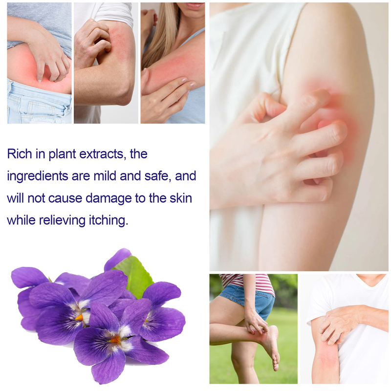 South Moon Zihua Di Ding Skin Antipruritus Tørr hud, kløe, rødhetslindrende fuktighetsgivende pleiekrem_voghion.com