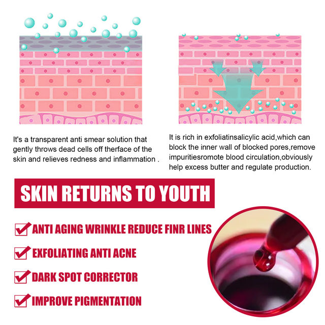 Pore Shrinking Serum Salisylsyre Frukt Acid Essence Glatte porer Anti Aldring Bghten Whitening Fuktighetsgivende hudpleieprodukt 30ml_voghion.com