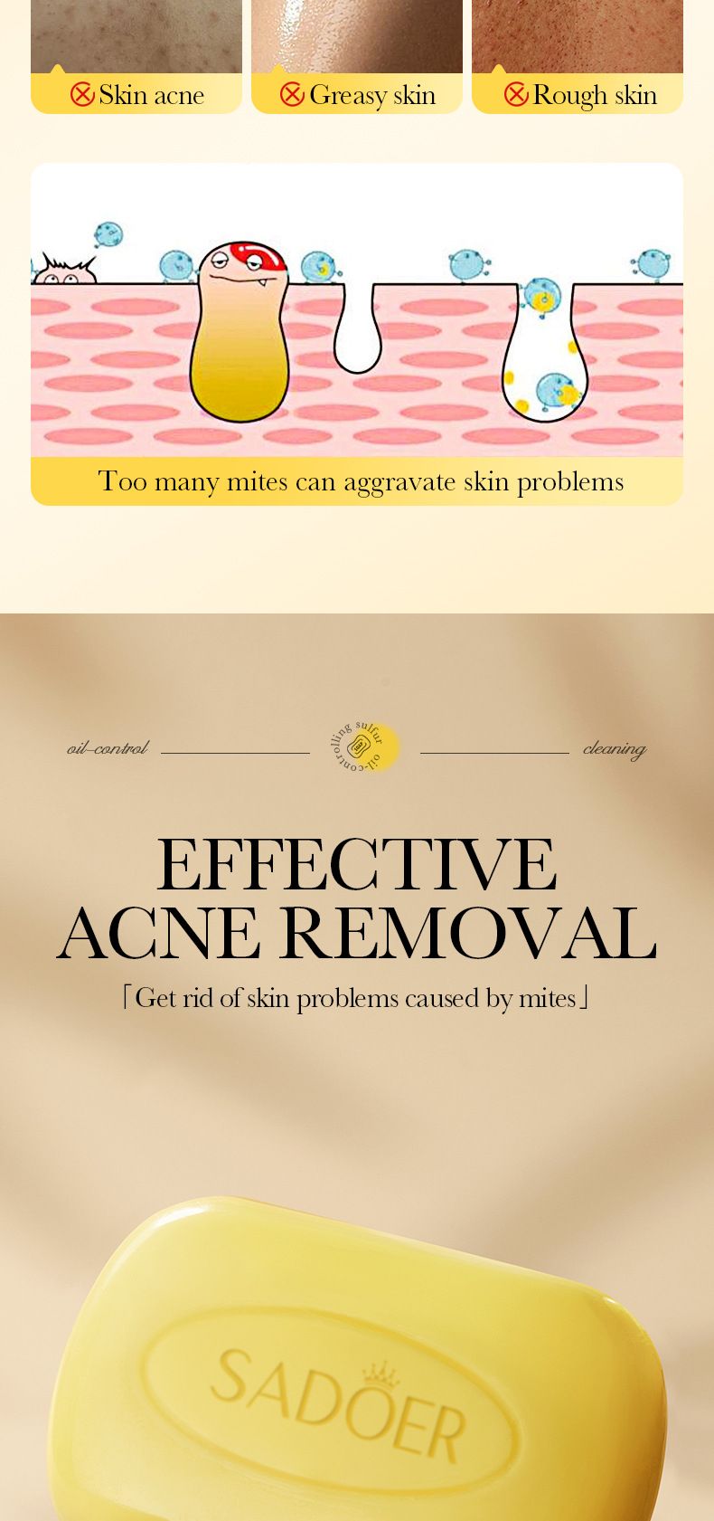 Rimozione completa degli acari dello zolfo in inglese 125 g Sapone profumato universale fatto a mano SADOER Clean Body_voghion.com