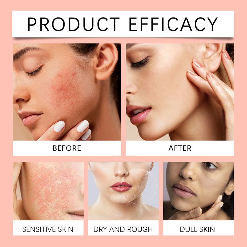 OUHOE Moisturizing Spray, Facial Toner Soothing And Moisturizing Skin Refreshing And Not Greasy And Gentle And Moisturizing_voghion.com