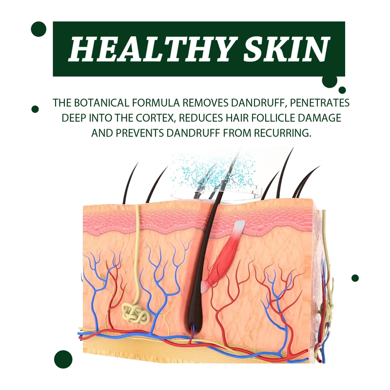 South Moon scalp anti-itch shampoo, scalp cleansing, anti-dandruff, hair oil control, anti-itching, refreshing and repairing_voghion.com