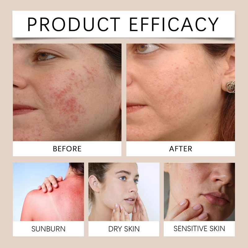OceAura Tallow Cream Hydrating Repair Dull And Moisturizing Skin Moisturizing Face Cream_voghion.com