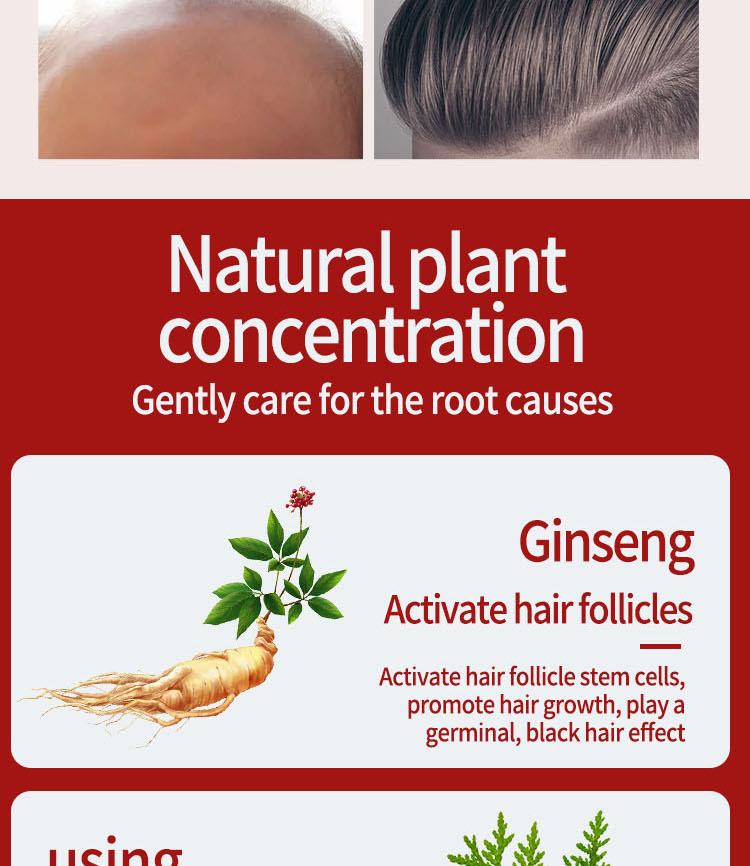 Biotin Fast 2023 Hoer Wuesstem Ueleg Hoer Wuesstem Serum Hoer Ausdünnung Behandlung Hoer Wuesstem Flëssegket Anti-Hoer Verloscht_voghion.com