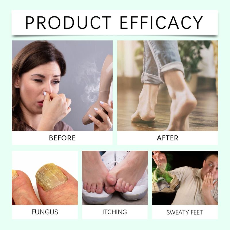 2025 Foot Care For Dry Feet, And Moisturizing Heels, Odor Removing Repair Agent_voghion.com