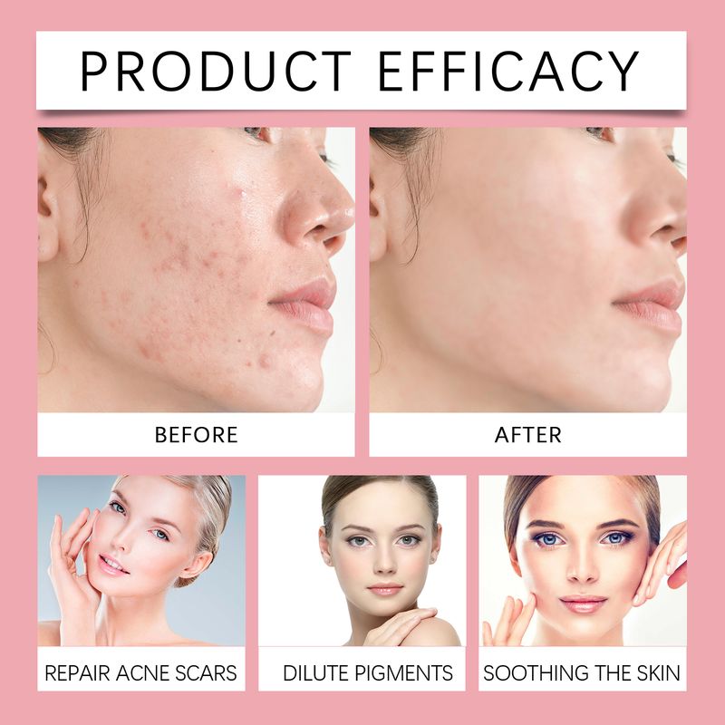 Hoygi Facial Essence, Moisturizing, Brightening And Moisturizing Facial Skin Exfoliating Gentle Cleansing Repair Essence_voghion.com