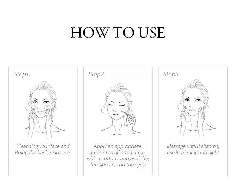 Trattamenti e maschere Crema anti-acne all'aloe vera 20 g Prodotti idratanti per la cura della pelle Confezione in inglese_voghion.com