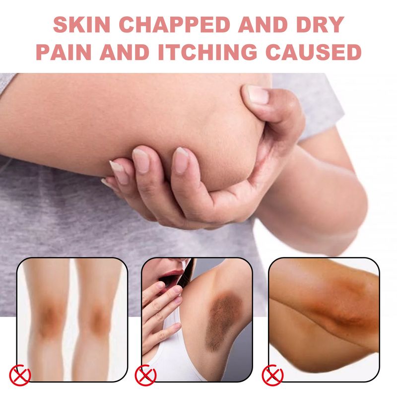 Hoygi Black Spot Care Cream Moisturizes The Skin, Making It Smooth And Radiant_voghion.com