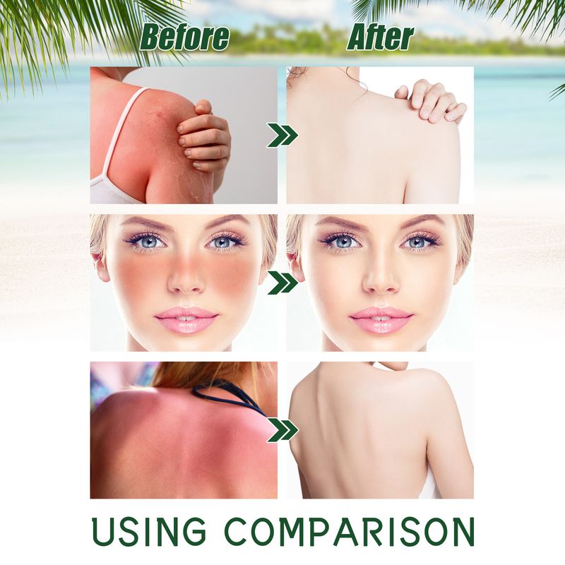 Aloe vera UV-szűrős, könnyű és frissítő, nem zsíros hidratáló védőkrém_voghion.com